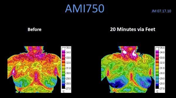 Upper Body Inflammation Decrease with Cymatherapy Chicago IL